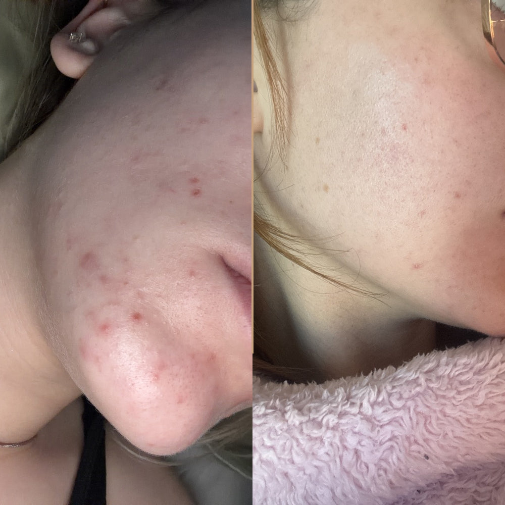 Velisse Radiance Gold Brightening Niacinamide Essence Serum Spray