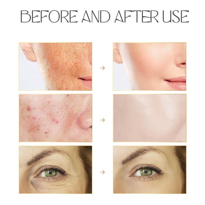 Advanced Radiance Snail 96% Mucin Essence Serum