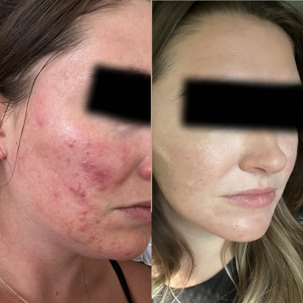 Velisse Radiance Gold Brightening Niacinamide Essence Serum Spray