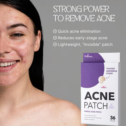 Velisse Blemish Care Hydrocolloid Spot Cover Patches (36–48 Patches)