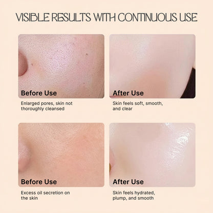 Walnut Polypeptide Cleansing Gel - Gentle Exfoliating & Nourishing Facial Cleanser