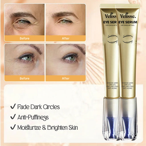 Caffeine 5% Retinol Anti-Wrinkle Eye Cream - Reduce Dark Circles, Puffiness & Fine Lines